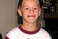 020-Goofy-teeth-11Apr-03